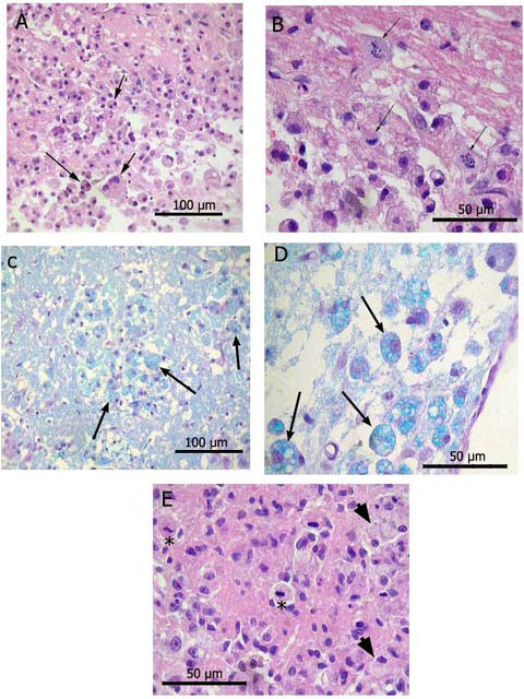 Figura 9. Macrfagos (flechas) en varias regiones cerebrales de animales IT-V.A: Macrfagos binucleados en cuerpo calloso.B: Macrfagos en mitosis en cuerpo calloso.C: Macrfagos en caudado-putamen. Luxol fast blue y PASD : Macrfagos cerca del ventrculo lateral. Luxol fast blue y PASE : Macrfagos con citoplasma vacuolado y en mitosis (asterisco) en tlamo.